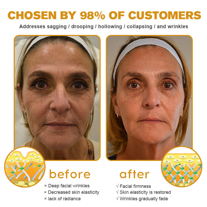 🔥 𝐂𝐥𝐞𝐚𝐧𝐬𝐢𝐚® 𝐀𝐝𝐯𝐚𝐧𝐜𝐞𝐝 𝐏𝐞𝐩𝐭𝐢𝐝𝐞𝐬 + 𝐕𝐢𝐭𝐚-𝐀 𝐑𝐞𝐭𝐢𝐧𝐨𝐥 𝐖𝐫𝐢𝐧𝐤𝐥𝐞-𝐋𝐢𝐟𝐭 𝐂𝐫𝐞𝐚𝐦 | 𝐒𝐦𝐨𝐨𝐭𝐡 𝐅𝐢𝐧𝐞 𝐋𝐢𝐧𝐞𝐬, 𝐅𝐢𝐫𝐦 & 𝐇𝐲𝐝𝐫𝐚𝐭𝐞 𝐒𝐤𝐢𝐧 — 𝟕𝟎% 𝐎𝐅𝐅!🎄