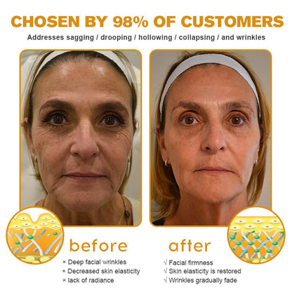 🔥 𝐂𝐥𝐞𝐚𝐧𝐬𝐢𝐚® 𝐀𝐝𝐯𝐚𝐧𝐜𝐞𝐝 𝐏𝐞𝐩𝐭𝐢𝐝𝐞𝐬 + 𝐕𝐢𝐭𝐚-𝐀 𝐑𝐞𝐭𝐢𝐧𝐨𝐥 𝐖𝐫𝐢𝐧𝐤𝐥𝐞-𝐋𝐢𝐟𝐭 𝐂𝐫𝐞𝐚𝐦 | 𝐒𝐦𝐨𝐨𝐭𝐡 𝐅𝐢𝐧𝐞 𝐋𝐢𝐧𝐞𝐬, 𝐅𝐢𝐫𝐦 & 𝐇𝐲𝐝𝐫𝐚𝐭𝐞 𝐒𝐤𝐢𝐧 — 𝟕𝟎% 𝐎𝐅𝐅!🎄